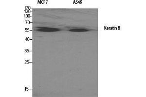 Western Blot (WB) analysis of specific cells using Cytokeratin 8 Polyclonal Antibody.