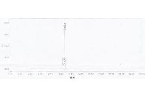 Image no. 2 for Pro-Brain Natriuretic Peptide (NT-ProBNP) (NT-ProBNP) (N-Term) peptide (Ovalbumin) (ABIN5666287) (Pro-Brain Natriuretic Peptide (NT-ProBNP) (NT-ProBNP) (N-Term) peptide (Ovalbumin))