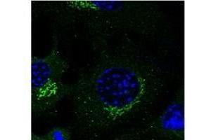 Immunostaining of macrophages With Rab14 antibody (1:50) (RAB3A 抗体  (C-Term))