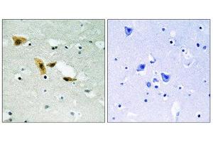 Immunohistochemistry (IHC) image for anti-Aprataxin and PNKP Like Factor (APLF) (Ser116) antibody (ABIN1848316)