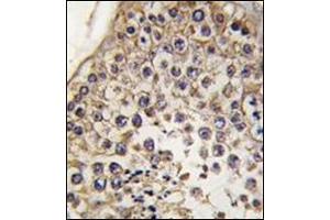Immunohistochemistry (Paraffin-embedded Sections) (IHC (p)) image for anti-Microtubule-Associated Protein 1 Light Chain 3 beta (MAP1LC3B) (AA 1-30), (N-Term) antibody (ABIN5555711)
