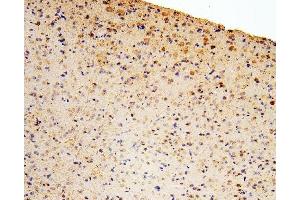 IHC analysis of GLI2 using anti-GLI2 antibody (ABIN6719569). (GLI2 抗体  (AA 721-1457))