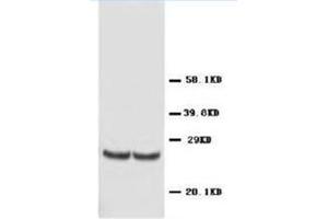 Western blot analysis of rat kidney tissue lysis using TIMP4 antibody (TIMP4 抗体  (C-Term))