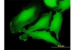 Immunofluorescence of purified MaxPab antibody to CRLF3 on HeLa cell. (CRLF3 抗体  (AA 1-442))