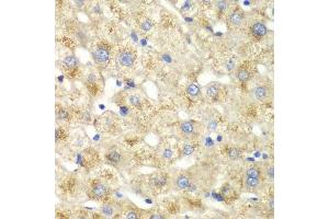 Immunohistochemistry of paraffin-embedded human liver injury using CALD1 antibody. (Caldesmon 抗体  (AA 1-240))