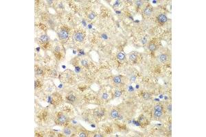 Immunohistochemistry of paraffin-embedded human liver injury using CALD1 antibody.