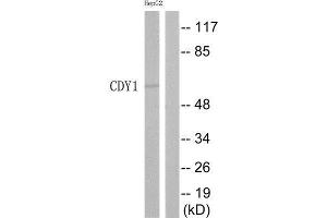 Western Blotting (WB) image for anti-Chromodomain Protein, Y-Linked, 1 (CDY1) (Internal Region) antibody (ABIN1852531) (CDY1 抗体  (Internal Region))