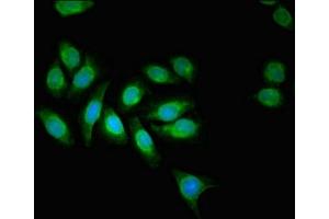 Immunofluorescent analysis of A549 cells using ABIN7143732 at dilution of 1:100 and Alexa Fluor 488-congugated AffiniPure Goat Anti-Rabbit IgG(H+L) (AAGAB 抗体  (AA 191-315))