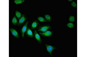 Immunofluorescent analysis of A549 cells using ABIN7143732 at dilution of 1:100 and Alexa Fluor 488-congugated AffiniPure Goat Anti-Rabbit IgG(H+L) (AAGAB 抗体  (AA 191-315))