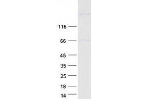 Western Blotting (WB) image for Bromodomain Containing 8 (BRD8) (Transcript Variant 2) protein (Myc-DYKDDDDK Tag) (ABIN2715328)