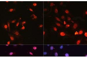 Immunofluorescence analysis of U2OS cells using Phospho-γH2A. (gamma H2AX 抗体  (pSer139))