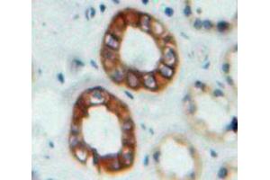 IHC-P analysis of Kidney tissue, with DAB staining. (Nephrin 抗体  (AA 27-234))