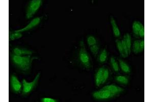Immunofluorescent analysis of Hela cells using ABIN7169141 at dilution of 1:100 and Alexa Fluor 488-congugated AffiniPure Goat Anti-Rabbit IgG(H+L) (PIM1 抗体  (AA 25-86))