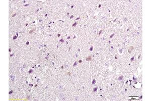 Immunohistochemistry (Paraffin-embedded Sections) (IHC (p)) image for anti-Glutamate Receptor, Ionotropic, N-Methyl D-Aspartate 2B (GRIN2B) (AA 451-550) antibody (ABIN726485)