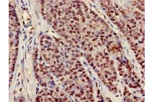 Immunohistochemistry (IHC) image for anti-Neural Precursor Cell Expressed, Developmentally Down-Regulated 9 (NEDD9) (AA 68-151) antibody (ABIN7151782)