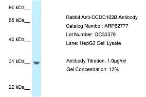 Western Blotting (WB) image for anti-Coiled-Coil Domain Containing 102B (CCDC102B) (N-Term) antibody (ABIN2789242) (CCDC102B 抗体  (N-Term))