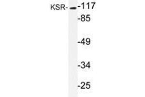 Western blot analysis of KSR antibody in extracts from NIH/3T3 cells. (KSR1 抗体)