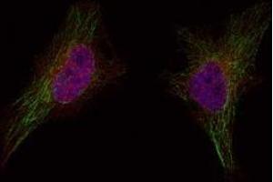 Image no. 1 for anti-Breast Cancer 1 (BRCA1) (Ser1524) antibody (ABIN401621) (BRCA1 抗体  (Ser1524))