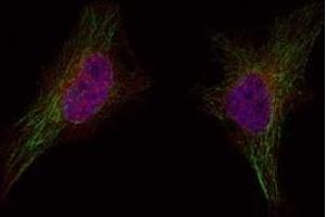 Image no. 1 for anti-Breast Cancer 1 (BRCA1) (Ser1524) antibody (ABIN401620) (BRCA1 抗体  (Ser1524))