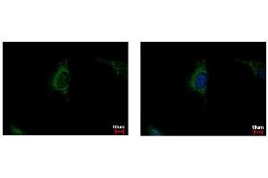 Immunofluorescence (IF) image for anti-Succinate Dehydrogenase Complex, Subunit A, Flavoprotein (Fp) (SDHA) (N-Term) antibody (ABIN2855128)