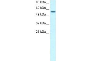 WB Suggested Anti-RUNX1T1 Antibody Titration:  1. (RUNX1T1 抗体  (Middle Region))