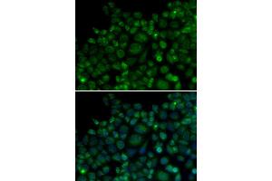 Immunofluorescence analysis of MCF7 cell using TLR7 antibody. (TLR7 抗体)
