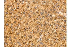 ABIN6258514 and ABIN6274732 at 1/100 staining Rat liver tissue by IHC-P.