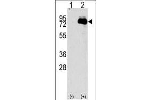 Western blot analysis of NUAK2 (arrow) using rabbit polyclonal NUAK2 Antibody (N-term) (R). (NUAK2 抗体  (N-Term))