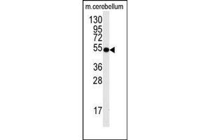 Image no. 1 for anti-Cell Division Cycle 25 Homolog A (S. Pombe) (CDC25A) (Ser78) antibody (ABIN358772) (CDC25A 抗体  (Ser78))