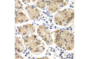 Immunohistochemistry of paraffin-embedded human normal stomach using CHIT1 antibody at dilution of 1:200 (400x lens). (Chitotriosidase 1 抗体)