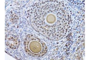 Immunohistochemistry (Paraffin-embedded Sections) (IHC (p)) image for anti-Proliferating Cell Nuclear Antigen (PCNA) (AA 1-261) antibody (ABIN3020826)