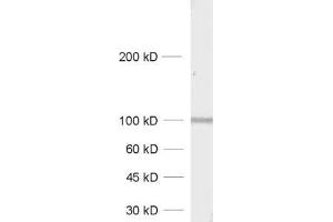 dilution: 1 : 1000, sample: synaptic membrane fraction of rat brain (LP1) (GRIA4 抗体  (AA 850-902))