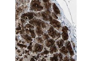 Immunohistochemical staining of human stomach with CDCA7 polyclonal antibody  shows strong cytoplasmic positivity in granular pattern in glandular cells at 1:200-1:500 dilution. (CDCA7 抗体)