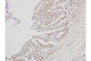 IHC-P Image Immunohistochemical analysis of paraffin-embedded OVCA xenograft, using interferon alpha 8, antibody at 1:500 dilution. (IFNA8 抗体)