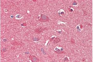 ABIN625820 (5µg/ml) staining of paraffin embedded Human Cortex. (CROT 抗体  (C-Term))