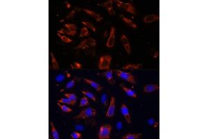 Immunofluorescence analysis of U-2OS cells using MCTS1 antibody (ABIN6132341, ABIN6143657, ABIN6143658 and ABIN6224877) at dilution of 1:100 (40x lens).