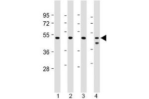 Western blot testing of human 1) Jurkat, 2) U-2 0S, 3) HeLa and 4) MCF7 cell lysate with PSMC2 antibody at 1:2000. (PSMC2 抗体)
