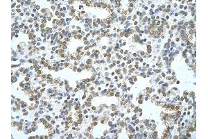 Rabbit Anti-ATG4B Antibody       Paraffin Embedded Tissue:  Human alveolar cell   Cellular Data:  Epithelial cells of renal tubule  Antibody Concentration:   4. (ATG4B 抗体  (C-Term))