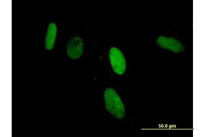 Immunofluorescence of purified MaxPab antibody to ZNF266 on HeLa cell. (ZNF266 抗体  (AA 1-263))
