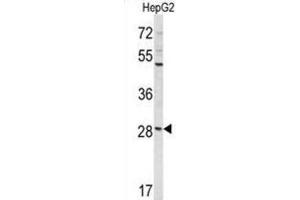 Western Blotting (WB) image for anti-Coiled-Coil Domain Containing 85B (CCDC85B) antibody (ABIN3004037) (CCDC85B 抗体)