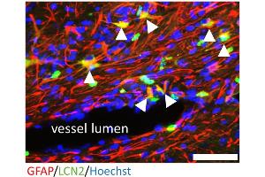 Astrocytes were found to be a source of LCN2 in WT Cup/EAE mice using GFAP (red) - LCN2 (green) double staining.