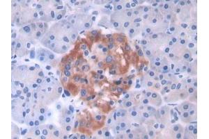 Detection of GLTP in Human Pancreas Tissue using Polyclonal Antibody to Glycolipid Transfer Protein (GLTP) (GLTP 抗体  (AA 2-209))