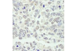 Immunohistochemistry (IHC) image for anti-Karyopherin alpha 3 (Importin alpha 4) (KPNA3) (AA 1-50) antibody (ABIN7448982) (KPNA3 抗体  (AA 1-50))