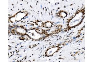 IHC analysis of NOLA1/GAR1 using anti-NOLA1/GAR1 antibody (ABIN7602076).