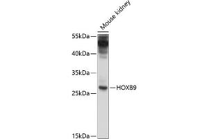 Western blot analysis of extracts of mouse kidney, using HOXB9 antibody  at 1:1000 dilution. (HOXB9 抗体  (AA 1-80))