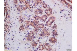 Immunohistochemistry (Paraffin-embedded Sections) (IHC (p)) image for anti-Mitofusin 2 (MFN2) (AA 1-120) antibody (ABIN682528)