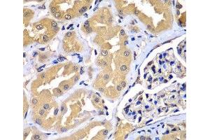 Immunohistochemistry of paraffin-embedded Human kidney using WIPI2 Polyclonal Antibody at dilution of 1:100 (40x lens). (WIPI2 抗体)