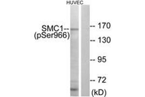 Western blot analysis of extracts from HuvEc cells treated with etoposide 24uM 24h, using SMC1 (Phospho-Ser966) Antibody. (SMC1A 抗体  (pSer966))