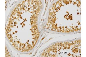 Immunostaining (ISt) image for anti-Peroxiredoxin 4 (PRDX4) (AA 51-150) antibody (ABIN564602)
