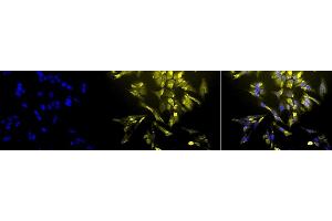 Immunocytochemistry/Immunofluorescence analysis using Mouse Anti-HO-1 Monoclonal Antibody, Clone 1F12-A6 (ABIN361696 and ABIN361697). (HMOX1 抗体  (AA 1-30))